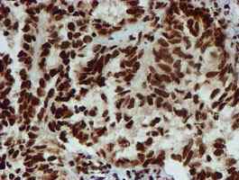 Immunohistochemistry (Formalin/PFA-fixed paraffin-embedded sections) - Anti-PADI4 / PAD4 antibody [OTI4H5] (ab128086), expandable thumbnail