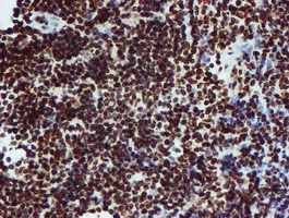 Immunohistochemistry (Formalin/PFA-fixed paraffin-embedded sections) - Anti-PADI4 / PAD4 antibody [OTI4H5] (ab128086), expandable thumbnail