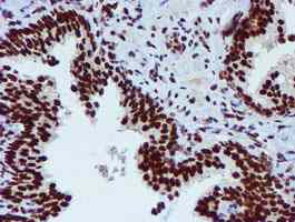 Immunohistochemistry (Formalin/PFA-fixed paraffin-embedded sections) - Anti-PADI4 / PAD4 antibody [OTI4H5] (ab128086), expandable thumbnail