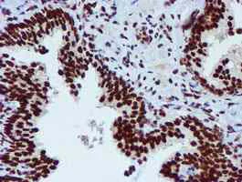 Immunohistochemistry (Formalin/PFA-fixed paraffin-embedded sections) - Anti-PADI4 / PAD4 antibody [OTI4H5] (AB128086)
