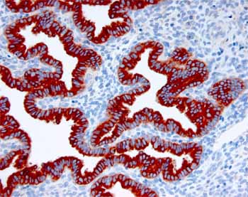 Immunohistochemistry (Formalin/PFA-fixed paraffin-embedded sections) - Anti-PAEP/Glycodelin antibody [13] (AB17247)