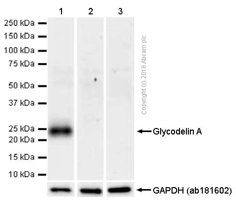 Western blot - Anti-PAEP/Glycodelin antibody [EP870Y] - BSA and Azide free (AB232406)