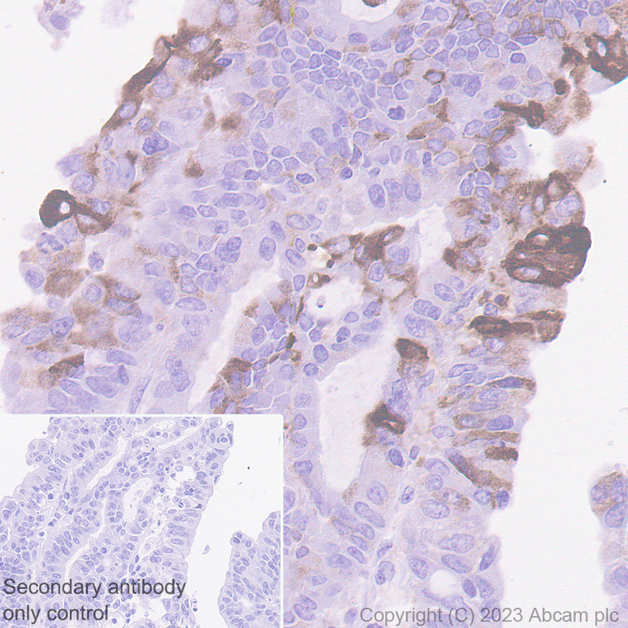 Immunohistochemistry (Formalin/PFA-fixed paraffin-embedded sections) - Anti-PAEP/Glycodelin antibody [EPR23251-87] (AB270454), expandable thumbnail