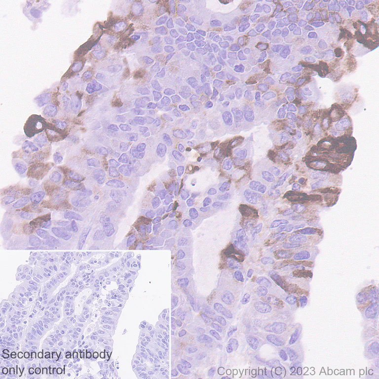 Immunohistochemistry (Formalin/PFA-fixed paraffin-embedded sections) - Anti-PAEP/Glycodelin antibody [EPR23251-87] - BSA and Azide free (AB270524)