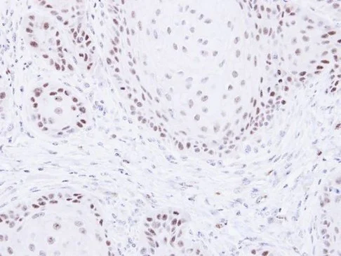 Immunohistochemistry (Formalin/PFA-fixed paraffin-embedded sections) - Anti-PAF1/PD2 antibody (AB137519)