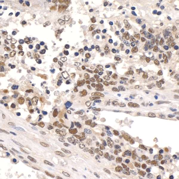 Immunohistochemistry (Formalin/PFA-fixed paraffin-embedded sections) - Anti-PAF1/PD2 antibody (AB70638), expandable thumbnail