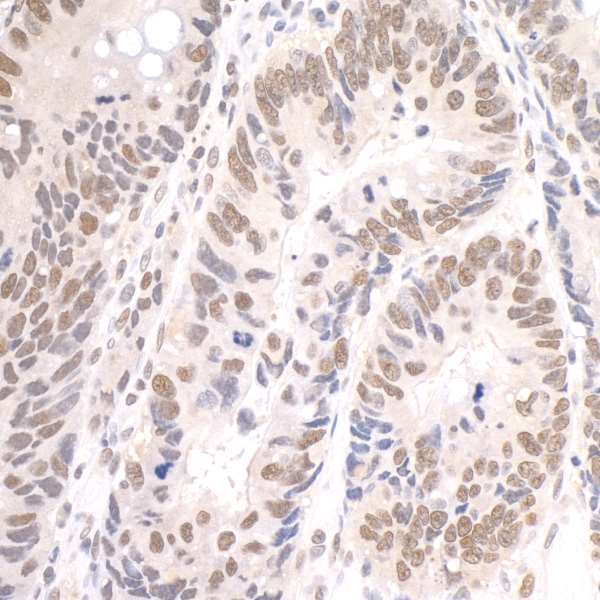 Immunohistochemistry (Formalin/PFA-fixed paraffin-embedded sections) - Anti-PAF1/PD2 antibody (AB84914), expandable thumbnail
