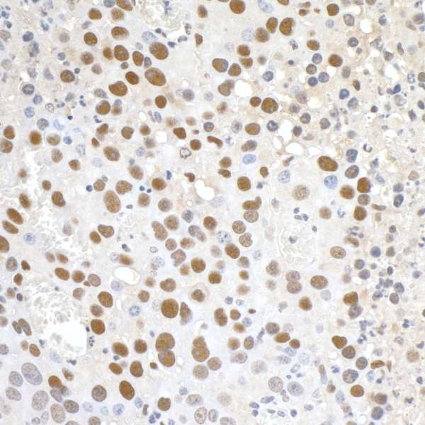 Immunohistochemistry (Formalin/PFA-fixed paraffin-embedded sections) - Anti-PAF1/PD2 antibody (AB84914), expandable thumbnail