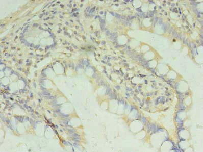 Immunohistochemistry (Formalin/PFA-fixed paraffin-embedded sections) - Anti-PAFAH1B2 antibody (AB238828)