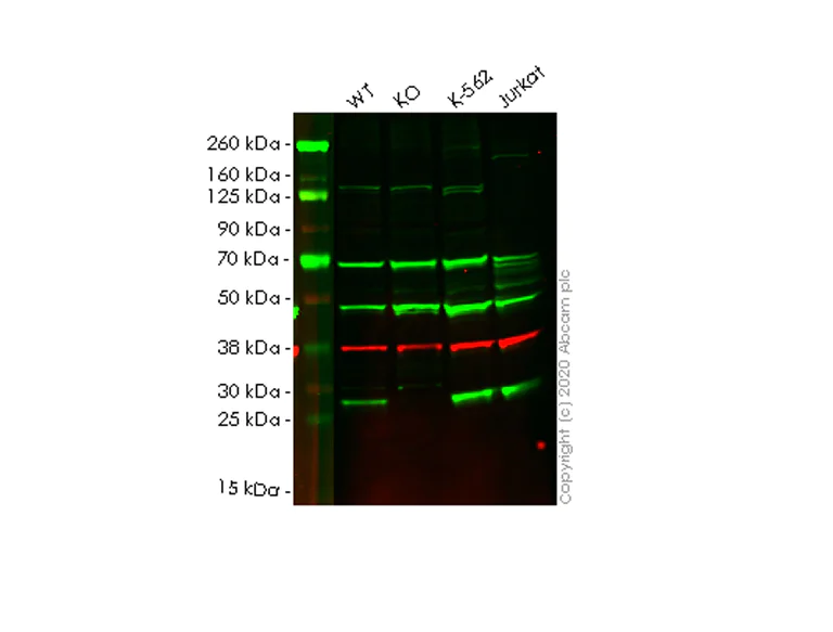 Western blot - Anti-PAFAH1B3 antibody [EPR11231-82] (AB166906)