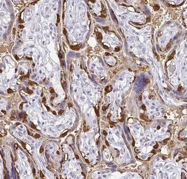 Immunohistochemistry (Formalin/PFA-fixed paraffin-embedded sections) - Anti-PAGE4 antibody (AB224454)