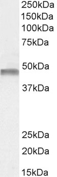 Western blot - Anti-PAH antibody (AB106805)