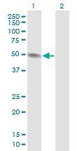 Western blot - Anti-PAH antibody (AB88740), expandable thumbnail
