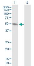 Western blot - Anti-PAH antibody (AB88740)