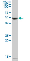 Western blot - Anti-PAH antibody (AB88740), expandable thumbnail