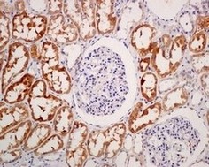Immunohistochemistry (Formalin/PFA-fixed paraffin-embedded sections) - Anti-PAH antibody [EPR12380] (AB178430), expandable thumbnail