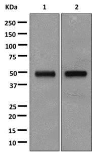 Western blot - Anti-PAH antibody [EPR12380] (AB178430), expandable thumbnail