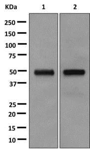 Western blot - Anti-PAH antibody [EPR12380] (AB178430)