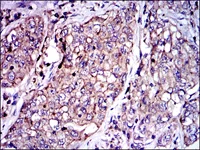 Immunohistochemistry (Formalin/PFA-fixed paraffin-embedded sections) - Anti-PAI1 antibody [1D5] (AB125687)