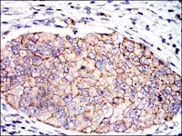Immunohistochemistry (Formalin/PFA-fixed paraffin-embedded sections) - Anti-PAI1 antibody [1D5] (AB125687)