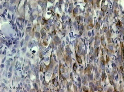 Immunohistochemistry (Formalin/PFA-fixed paraffin-embedded sections) - Anti-PAI1 antibody (AB31280)