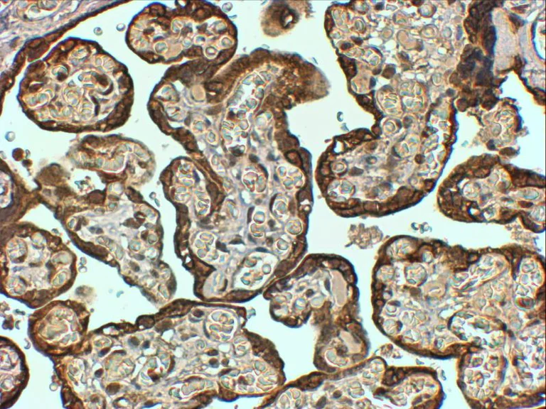 Immunohistochemistry (Formalin/PFA-fixed paraffin-embedded sections) - Anti-PAI1 antibody (AB31280)