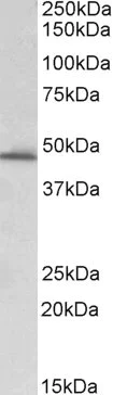 Western blot - Anti-PAI1 antibody (AB31280)