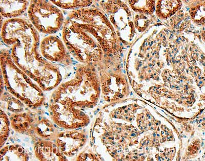 Immunohistochemistry (Formalin/PFA-fixed paraffin-embedded sections) - Anti-PAI1 antibody (AB66705)