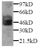 Western blot - Anti-PAI1 antibody (AB7205)