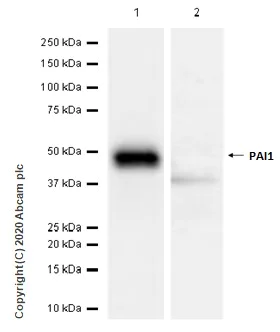 Western blot - Anti-PAI1 antibody [EPR17272-21] (AB182973)