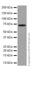 Western blot - Anti-PAI1 antibody [EPR17796] (AB187263)