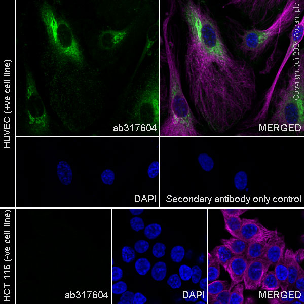 Anti-PAI1 antibody [EPR21850-262] (ab317604) | Abcam