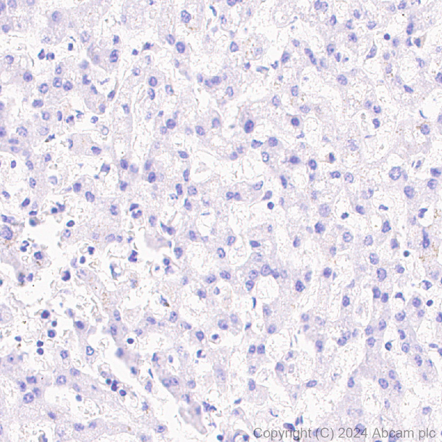 Immunohistochemistry (Formalin/PFA-fixed paraffin-embedded sections) - Anti-PAI1 antibody [EPR21850-262] (AB317604)