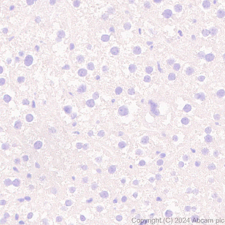 Immunohistochemistry (Formalin/PFA-fixed paraffin-embedded sections) - Anti-PAI1 antibody [EPR21850-262] (AB317604)