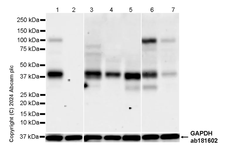 Western blot - Anti-PAI1 antibody [EPR21850-262] (AB317604)