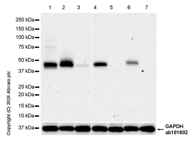 Western blot - Anti-PAI1 antibody [EPR21850-262] (AB317604)