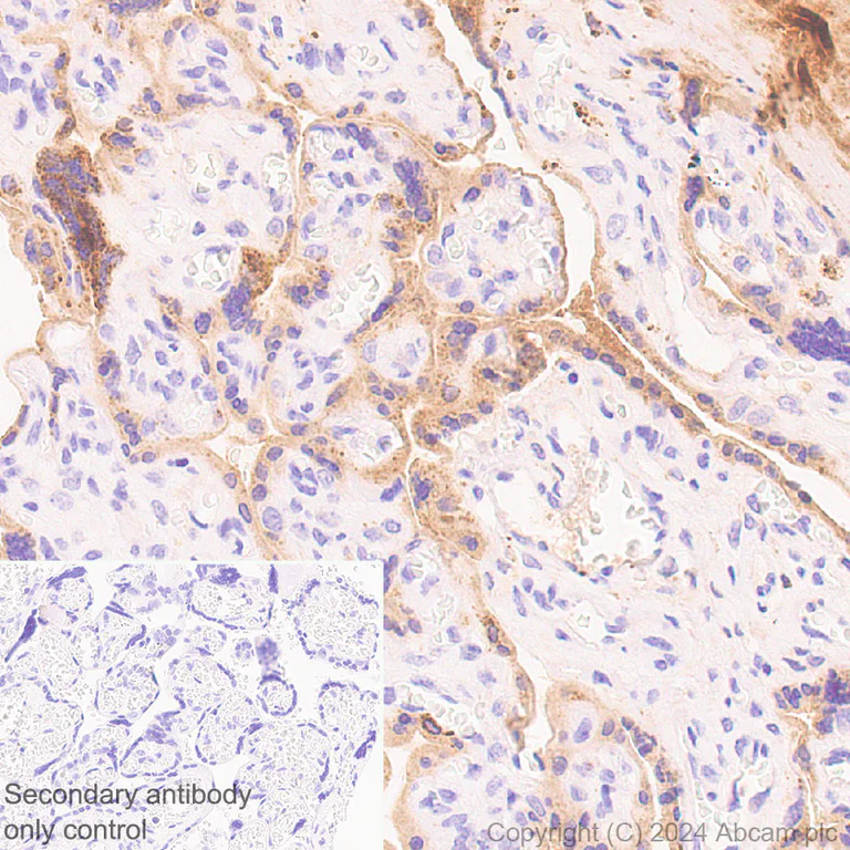 Immunohistochemistry (Formalin/PFA-fixed paraffin-embedded sections) - Anti-PAI1 antibody [EPR21850-262] - BSA and Azide free (AB317605)