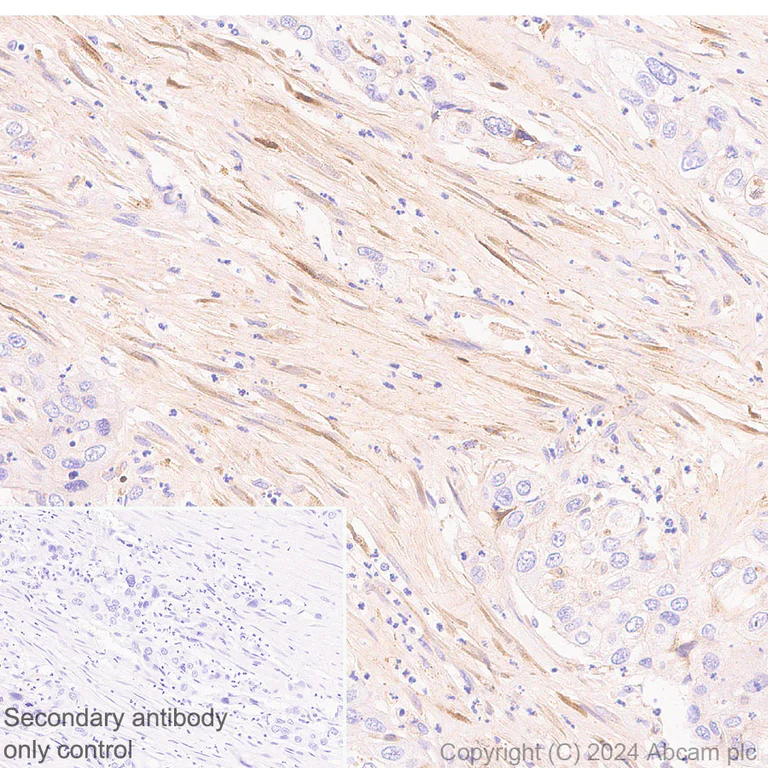 Immunohistochemistry (Formalin/PFA-fixed paraffin-embedded sections) - Anti-PAI1 antibody [EPR21850-262] - BSA and Azide free (AB317605)