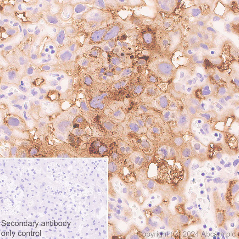 Immunohistochemistry (Formalin/PFA-fixed paraffin-embedded sections) - Anti-PAI1 antibody [EPR21850-262] - BSA and Azide free (AB317605)