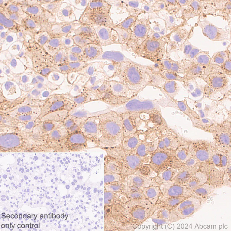 Immunohistochemistry (Formalin/PFA-fixed paraffin-embedded sections) - Anti-PAI1 antibody [EPR21850-262] - BSA and Azide free (AB317605)