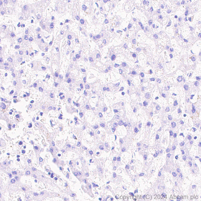 Immunohistochemistry (Formalin/PFA-fixed paraffin-embedded sections) - Anti-PAI1 antibody [EPR21850-262] - BSA and Azide free (AB317605)