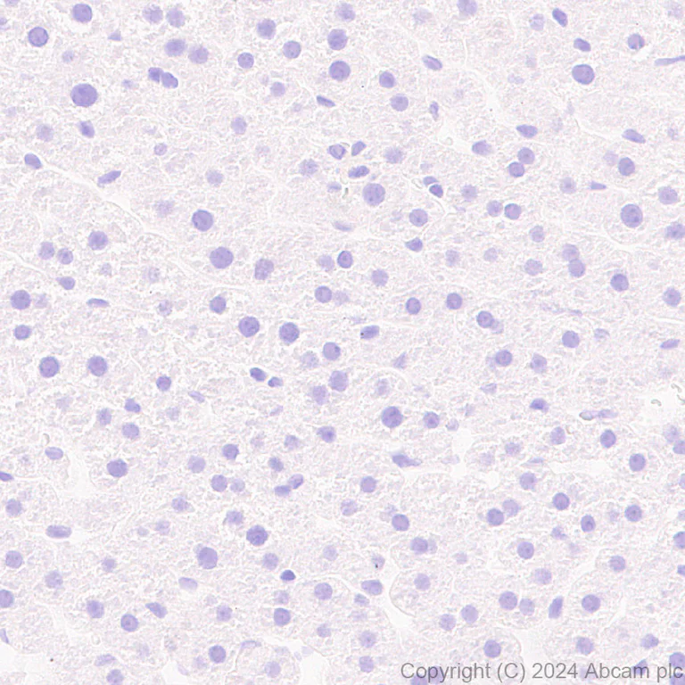 Immunohistochemistry (Formalin/PFA-fixed paraffin-embedded sections) - Anti-PAI1 antibody [EPR21850-262] - BSA and Azide free (AB317605)