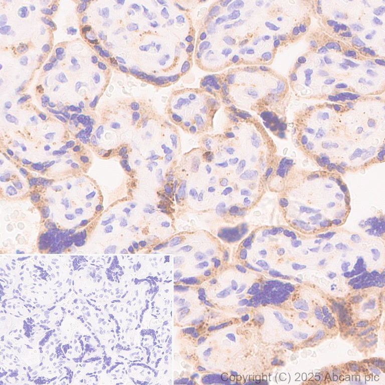 Immunohistochemistry (Formalin/PFA-fixed paraffin-embedded sections) - Anti-PAI1 antibody [EPR21850-262] - BSA and Azide free (Detector) (AB269409)