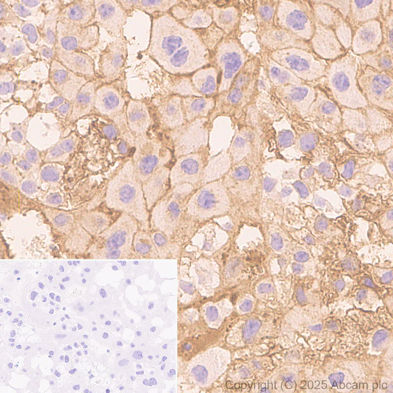 Immunohistochemistry (Formalin/PFA-fixed paraffin-embedded sections) - Anti-PAI1 antibody [EPR21850-262] - BSA and Azide free (Detector) (AB269409)