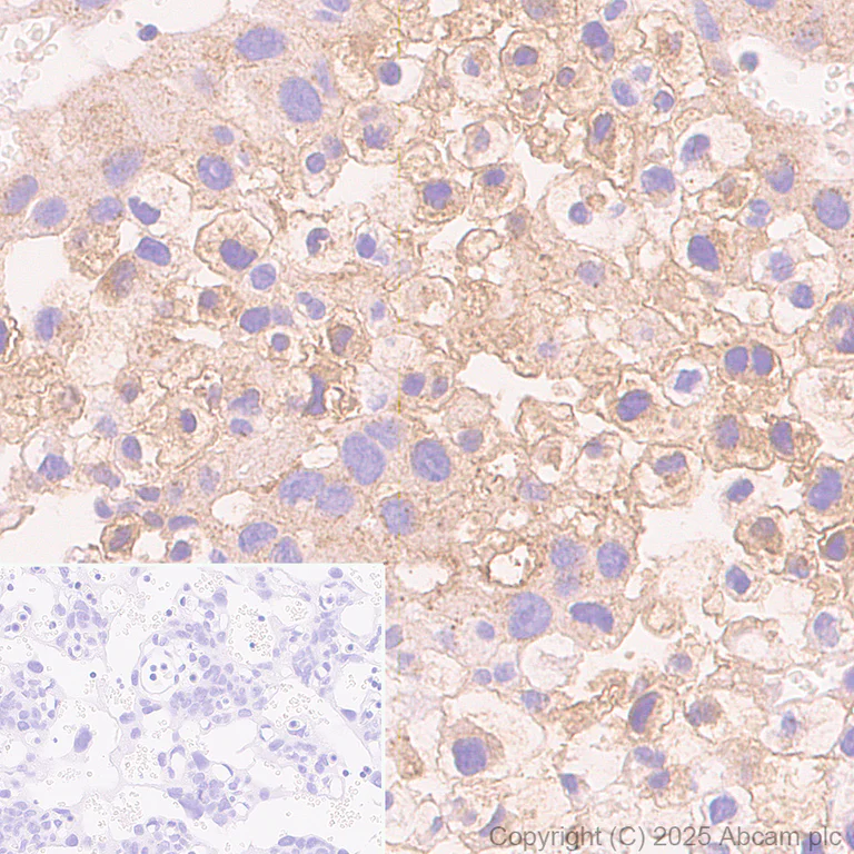 Immunohistochemistry (Formalin/PFA-fixed paraffin-embedded sections) - Anti-PAI1 antibody [EPR21850-262] - BSA and Azide free (Detector) (AB269409)