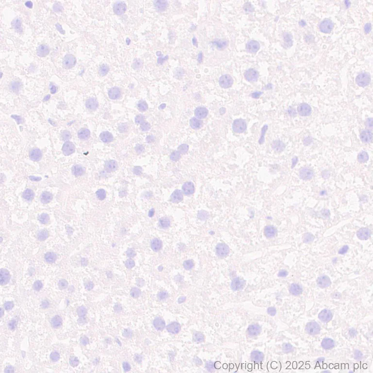Immunohistochemistry (Formalin/PFA-fixed paraffin-embedded sections) - Anti-PAI1 antibody [EPR21850-262] - BSA and Azide free (Detector) (AB269409)