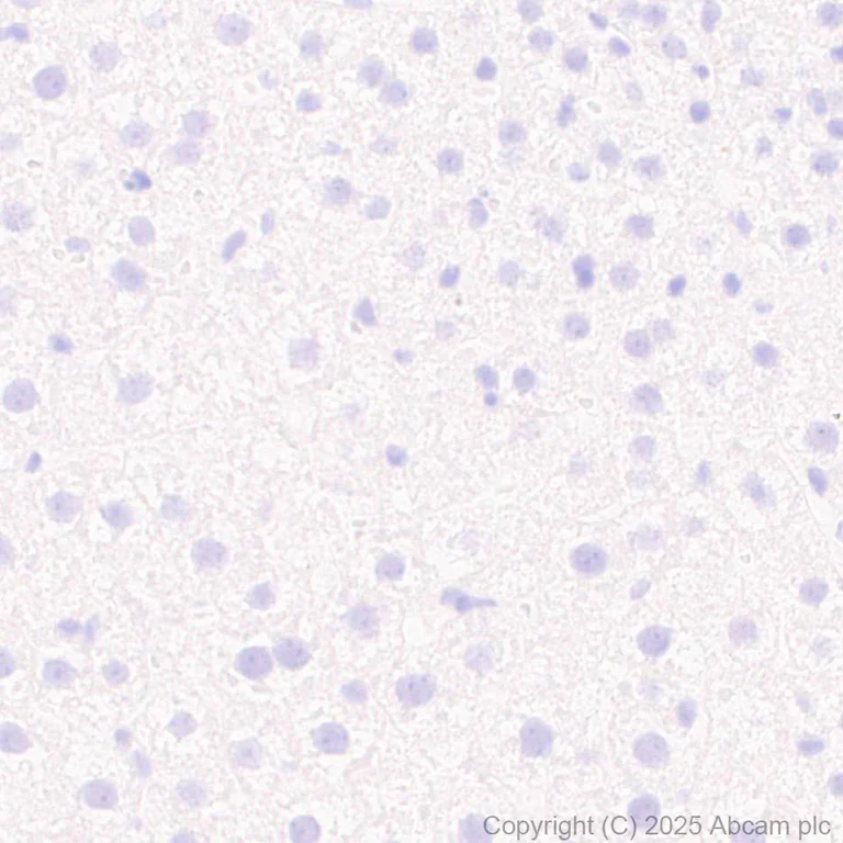 Immunohistochemistry (Formalin/PFA-fixed paraffin-embedded sections) - Anti-PAI1 antibody [EPR21850-262] - BSA and Azide free (Detector) (AB269409)