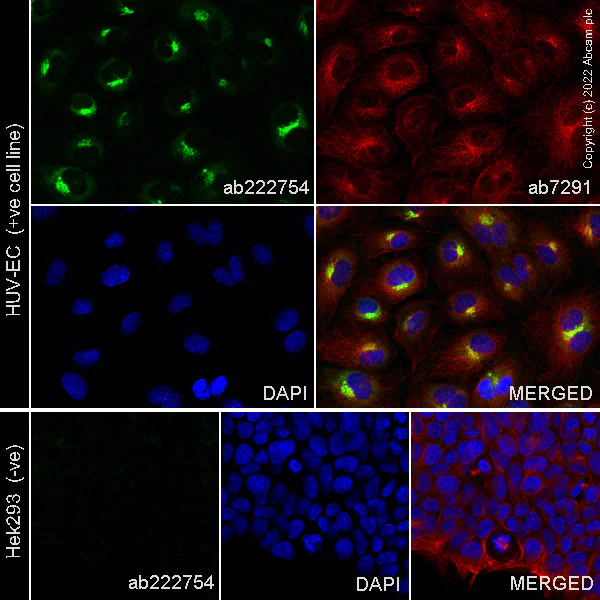 Immunocytochemistry/ Immunofluorescence - Anti-PAI1 antibody [EPR21850-82] (AB222754)