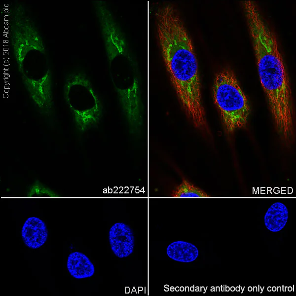 Anti-PAI1 antibody [EPR21850-82] (ab222754) | Abcam