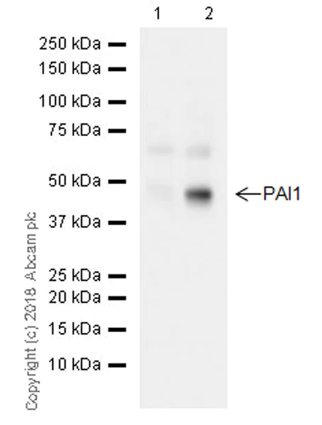 Western blot - Anti-PAI1 antibody [EPR21850-82] (AB222754)